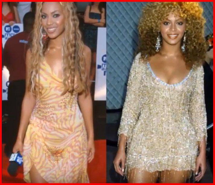 Beyonce Plastic Surgery Photos Celebrities Plastic Surgery
