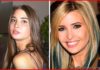 Ivanka Trump Plastic Surgery before and after 2