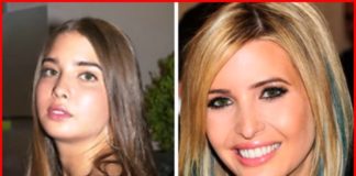 Ivanka Trump Plastic Surgery before and after 2