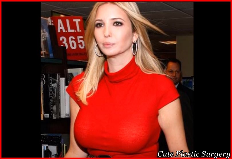 Ivanka Trump Breast Implants - Before and After Pictures. 