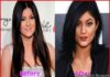 Kylie-Jenner-Plastic-Surgery-Before-and-After