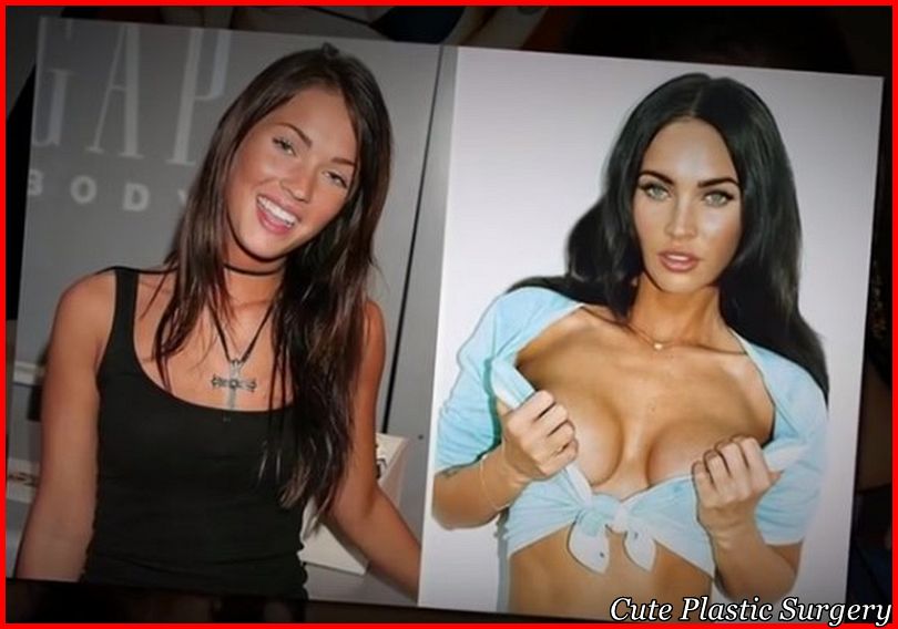 Megan Fox Breast Implants 1 Megan Fox Breast Implants 1