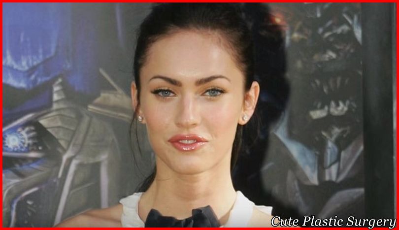 Megan Fox Plastic Surgery Pictures Revealed - Celebrities Plastic Surgery