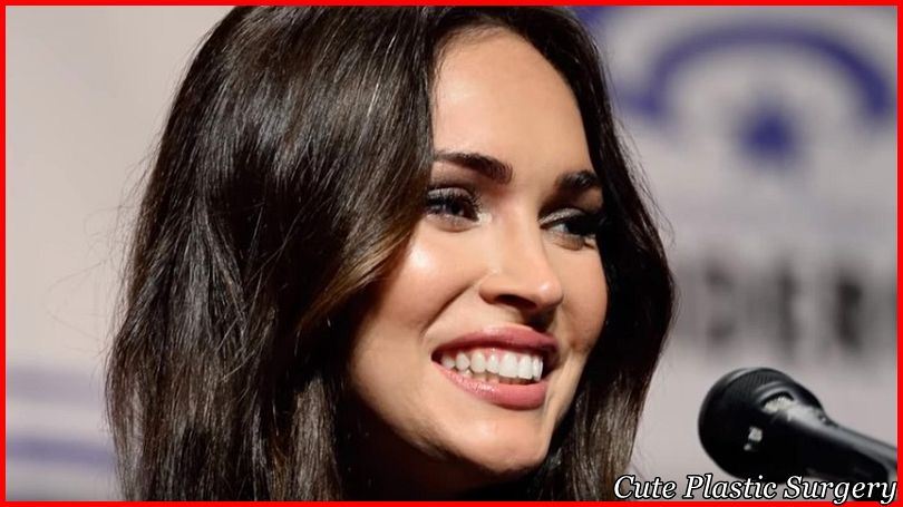 Megan Fox Plastic Surgery Pictures Revealed - Celebrities Plastic Surgery