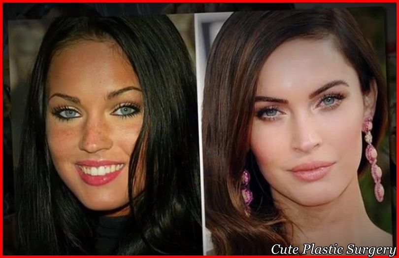 Megan Fox Plastic Surgery Pictures Revealed Celebrities Plastic Surgery