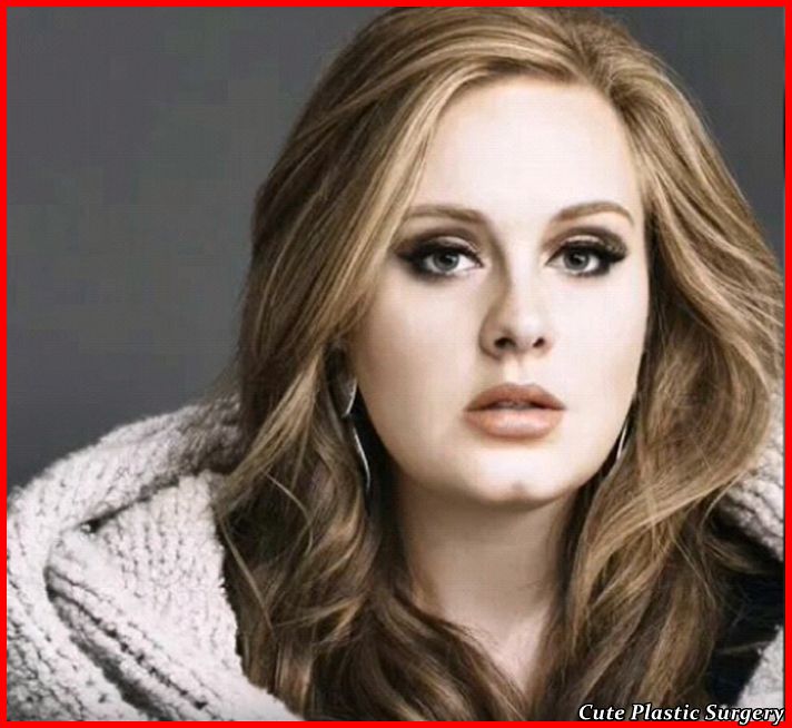 Adele Plastic Surgery Evolution - Rhinoplasty, Liposuction ...