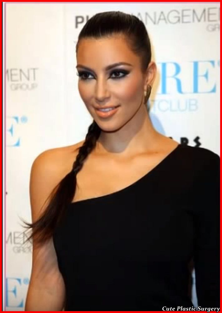 Kim Kardashian Breast Implants Plastic Surgery Before and 