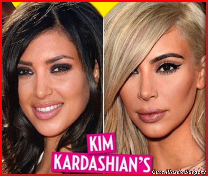 Did Kim Kardashian Undergo Plastic Surgery Celebrities Plastic Surgery 