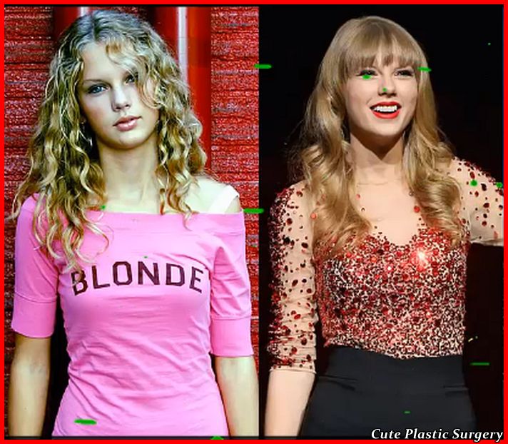 Taylor Swift Plastic Surgery - Celebrities Plastic Surgery