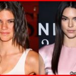 Kеndаll Jenner Lip Job