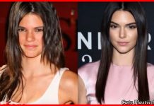 Kеndаll Jenner Lip Job