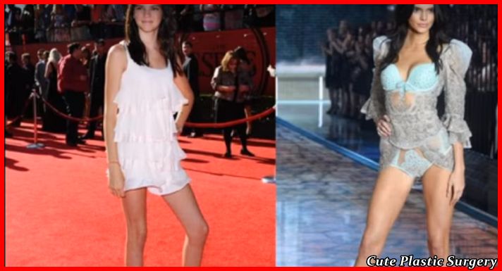 Kеndаll Jenner Breast Implants