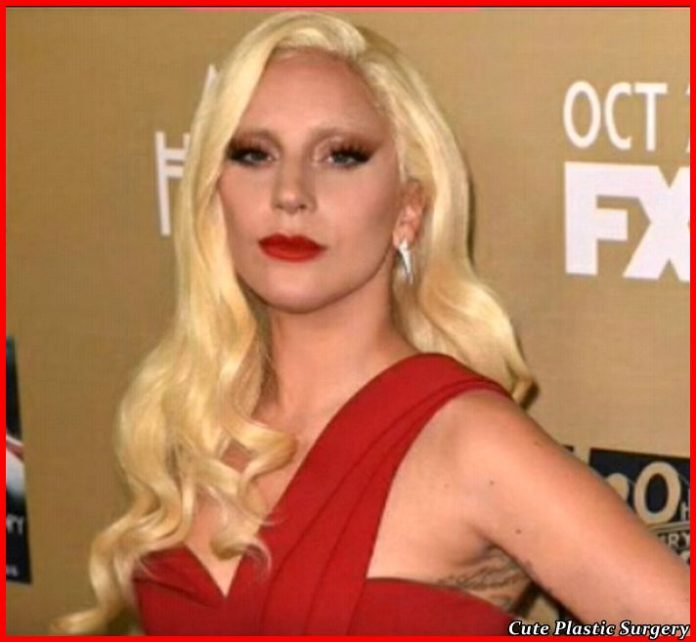 Lady Gaga Plastic Surgery Rumors - Celebrities Plastic Surgery