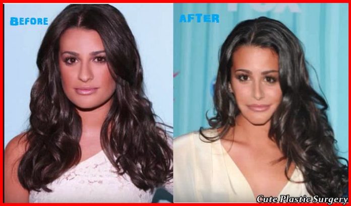 Did Lea Michele Get A Nose Job Celebrities Plastic Surgery 