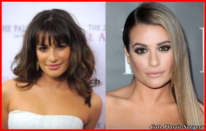 Did Lea Michele Get a Nose Job? - Celebrities Plastic Surgery