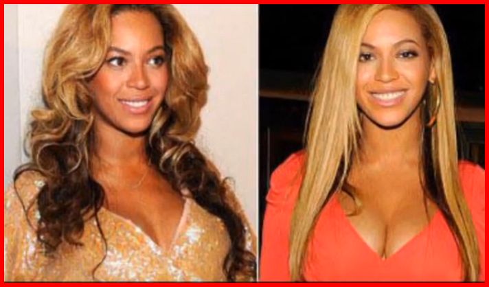 Beyonce Breast Enlargement