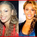 Beyonce Plastic Surgery