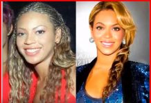 Beyonce Plastic Surgery
