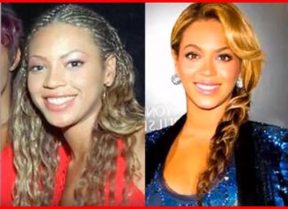 Beyonce Plastic Surgery