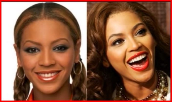 Beyonce Plastic Surgery Photos - Celebrities Plastic Surgery