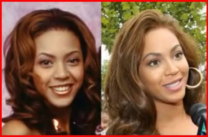 Beyonce Plastic Surgery Photos - Celebrities Plastic Surgery