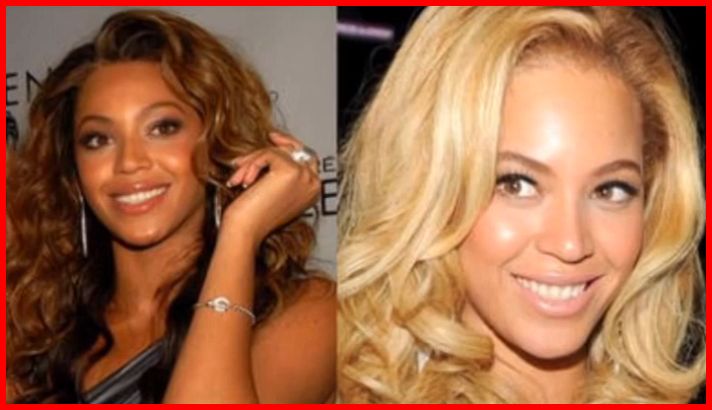 Beyonce Skin lightening before and after