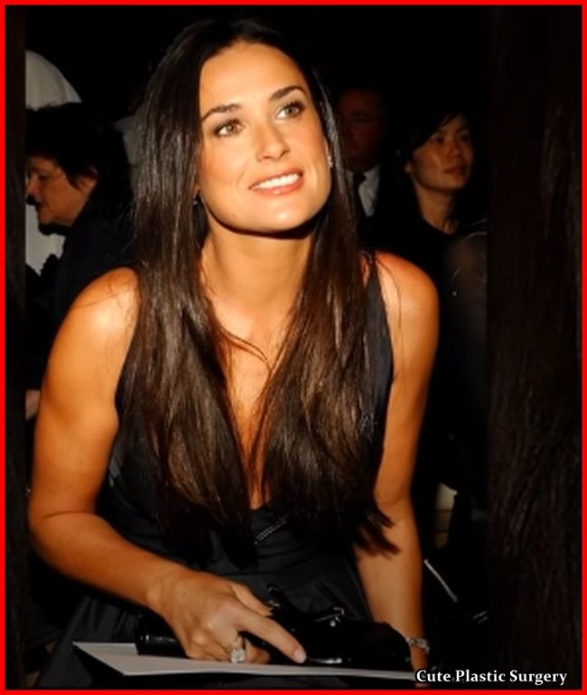 Demi Moore Plastic Surgery - Celebrities Plastic Surgery