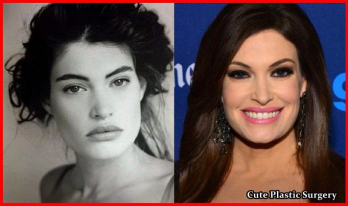 Has Kimberly Guilfoyle Undergone Breast Implants - Celebrities Plastic ...