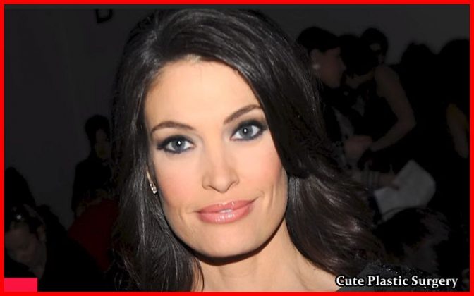 Has Kimberly Guilfoyle Undergone Breast Implants - Celebrities Plastic ...