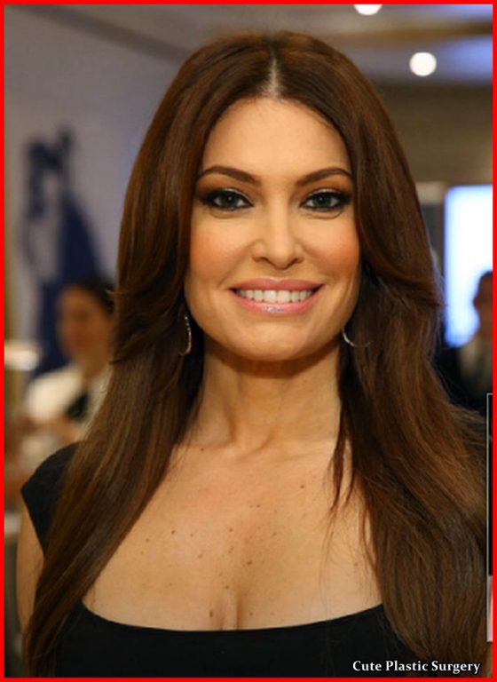 Has Kimberly Guilfoyle Undergone Breast Implants - Celebrities Plastic