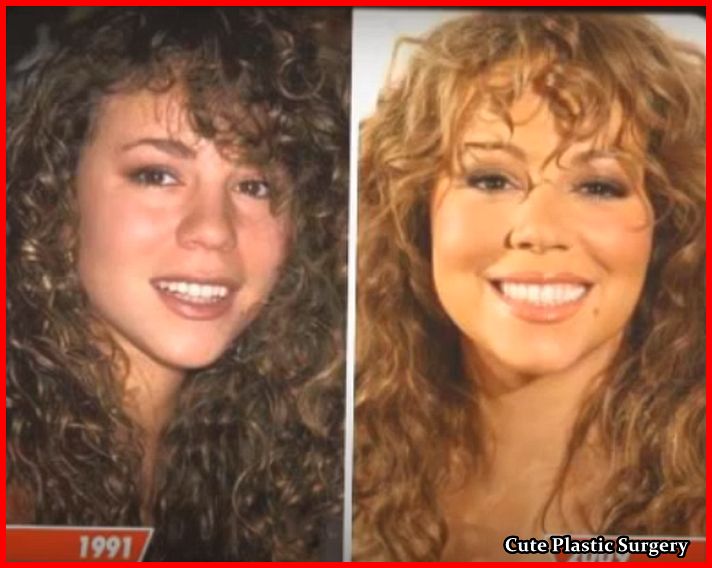 Did Mariah Carey Underwent Breast Implants? Celebrities