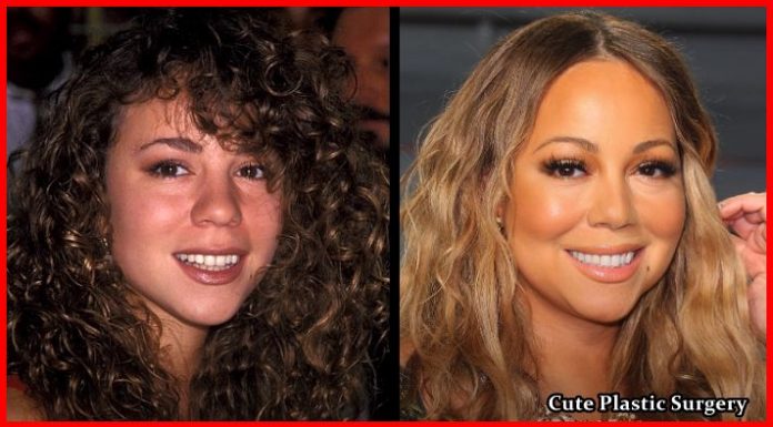 Did Mariah Carey Underwent Breast Implants? - Celebrities Plastic Surgery