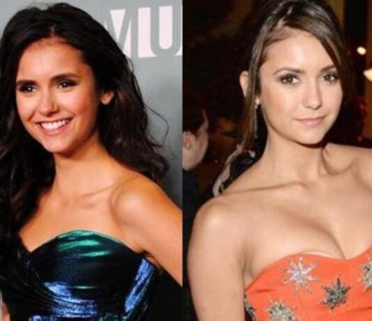 Nina Dobrev Speculations About Plastic Surgery